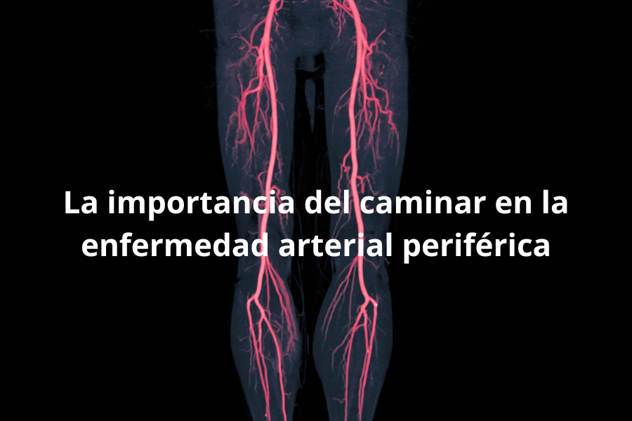 Aumentando los pasos en la enfermedad arterial periférica